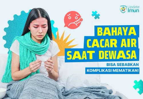 Bahaya Cacar Air Saat Dewasa, Bisa Sebabkan Komplikasi Mematikan!